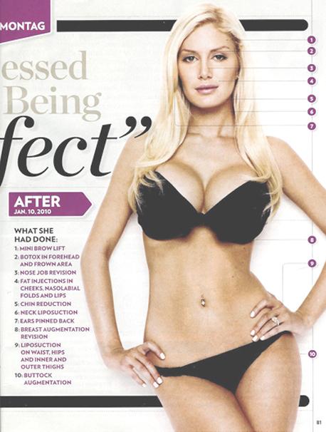 heidi montag before and after 2011. heidi montag before plastic
